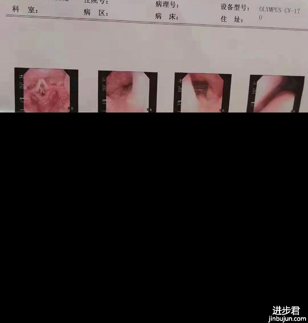 过敏性鼻炎很严重怎么办？会遗传吗？如何治疗？干货分享