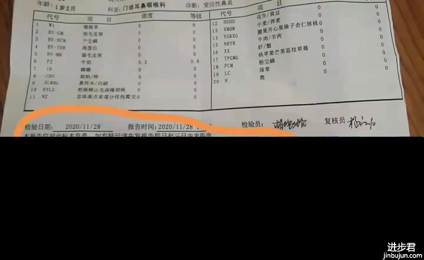 过敏性鼻炎很严重怎么办？会遗传吗？如何治疗？干货分享