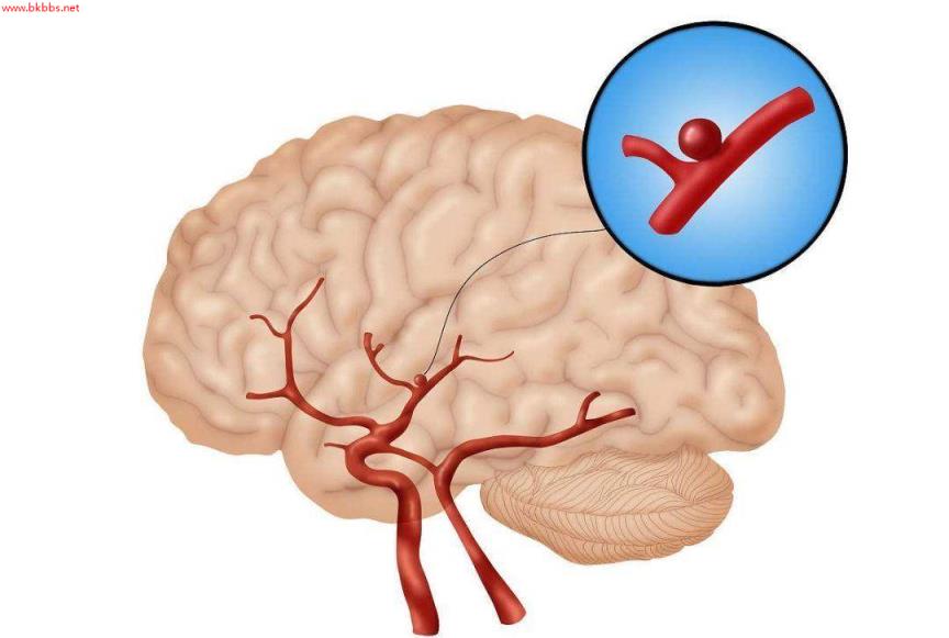 头晕和眩晕如何区分？眩晕恐为疾病前兆！中枢性周围性眩晕大不同