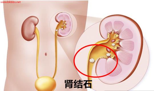 腹部彩超检查要注意什么？除了空腹，这2点也要牢记