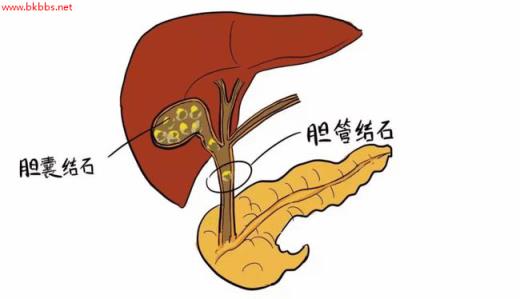 腹部彩超检查要注意什么？除了空腹，这2点也要牢记