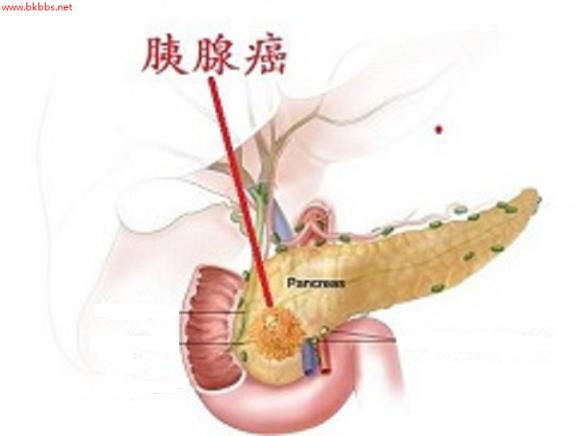 腹部彩超检查要注意什么？除了空腹，这2点也要牢记