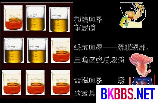 尿血怎么回事