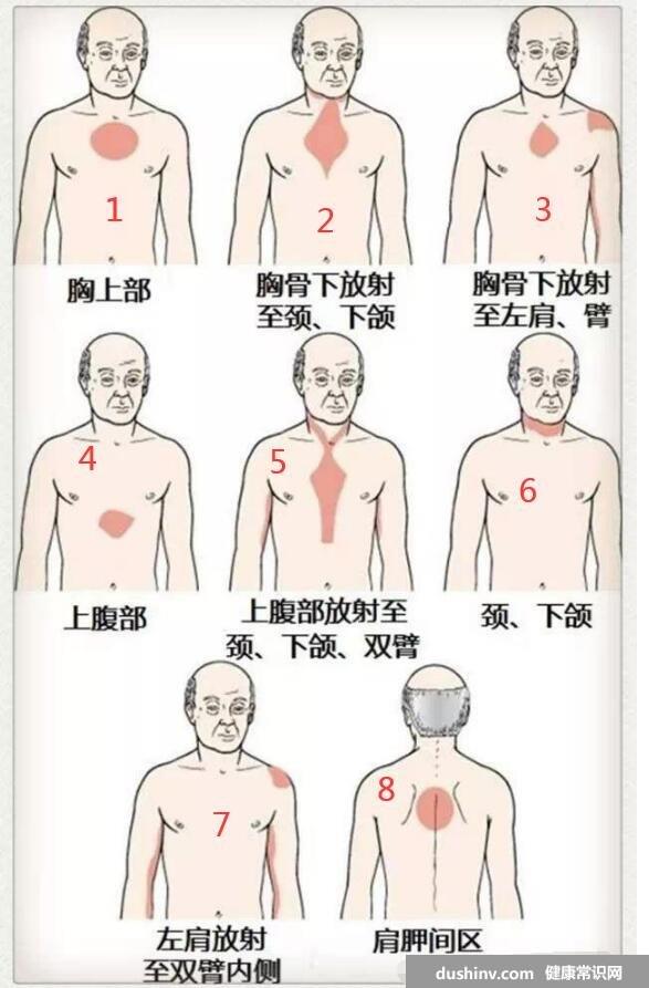 警惕心脏不好早期10个征兆，对比心脏疼痛的位置图来自测