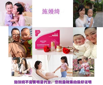 多年的妊娠纹怎么去除 去除妊娠纹用什么好