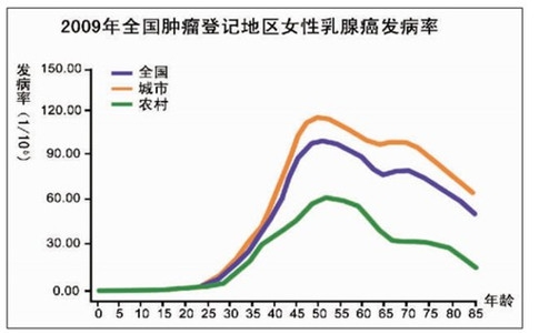 乳腺癌