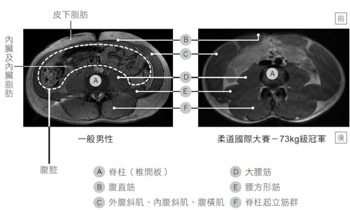 腹部肌肉,脂肪