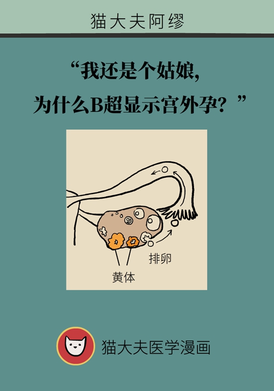 这种腹痛常被误认宫外孕，背后诱因要牢记