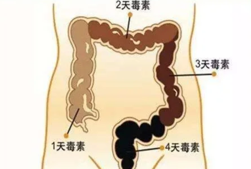 怎样看拉出来的是宿便3