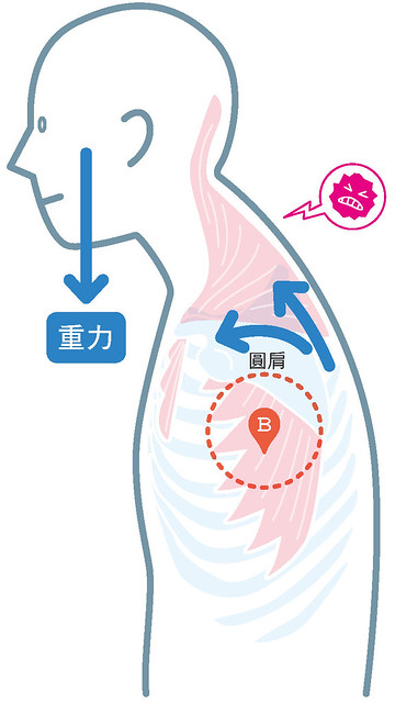 颈部至肩膀的不适：摩擦肩胛处，调整高低肩问题