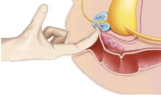前列腺快感是怎样的感觉