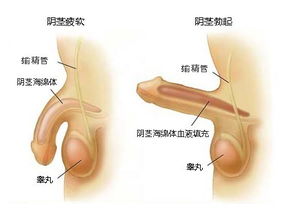 阴茎异常勃起为什么会疼 萍乡新世纪男科医院 